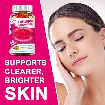 Catfit Collagen Gummies Biotin Hair Capsules Beauty Health Skin Hydrolyzed Nail Bone Joint Wrinkles Vitamin Hair Nutrition Diet