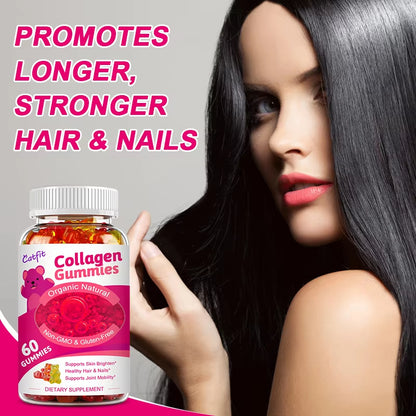 Catfit Collagen Gummies Biotin Hair Capsules Beauty Health Skin Hydrolyzed Nail Bone Joint Wrinkles Vitamin Hair Nutrition Diet