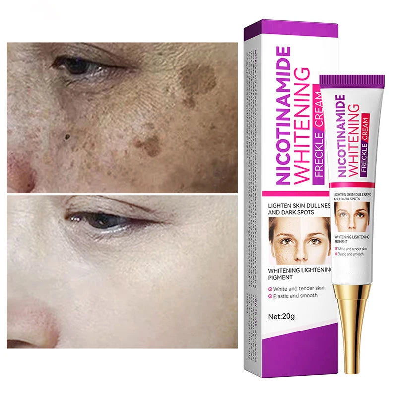 2024 Niacinamide Whitening Freckle Cream Effectively Remove Melasma Cream Lightens Black Spots Acne Marks Brightens Skin Care