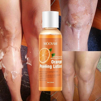 Hot Orange Yellow Peeling Lotion Oil Bleaching Dark Skin Retinol Peptide Spots Blackhead Blemishes Bad Skin Spot Treatment Care