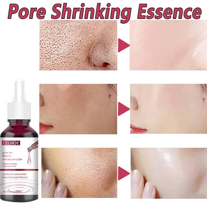 Pore Shrinking Serum Smooth Pores Whitening Moisturizing Anti Aging Brighten Skin Care Product Salicylic Fruit Acid Essence