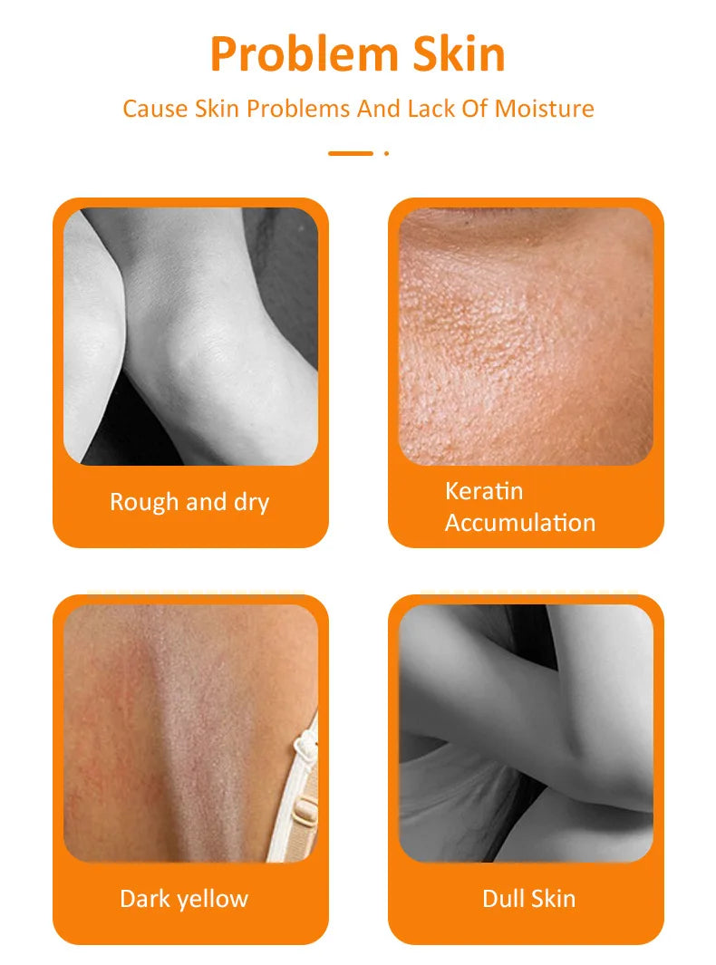 Hot Orange Yellow Peeling Lotion Oil Bleaching Dark Skin Retinol Peptide Spots Blackhead Blemishes Bad Skin Spot Treatment Care