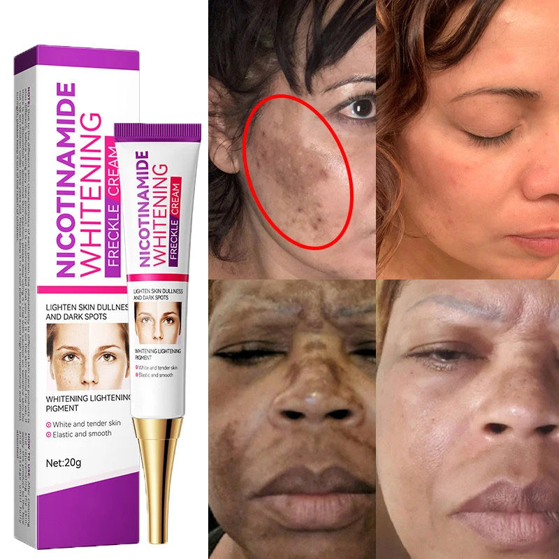 2024 Niacinamide Whitening Freckle Cream Effectively Remove Melasma Cream Lightens Black Spots Acne Marks Brightens Skin Care