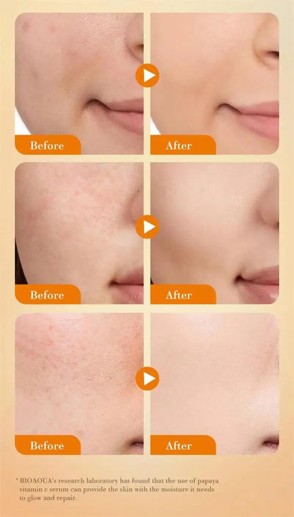 Whitening Serum Effective Remove Freckle Liquid Fade Melanin Fade Dark Spots Melasma Whiten Brighten Skin Care Products