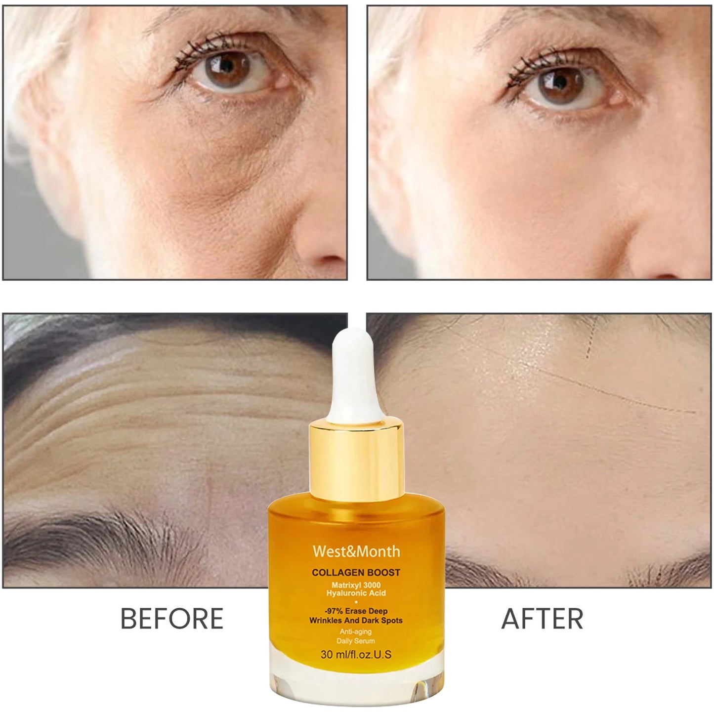 Collagen Face Serum Wrinkle Removalr Whitening Moisturizing Fade Fine Lines Dark Anti Aging Spots Korean Face Care Cosmetics