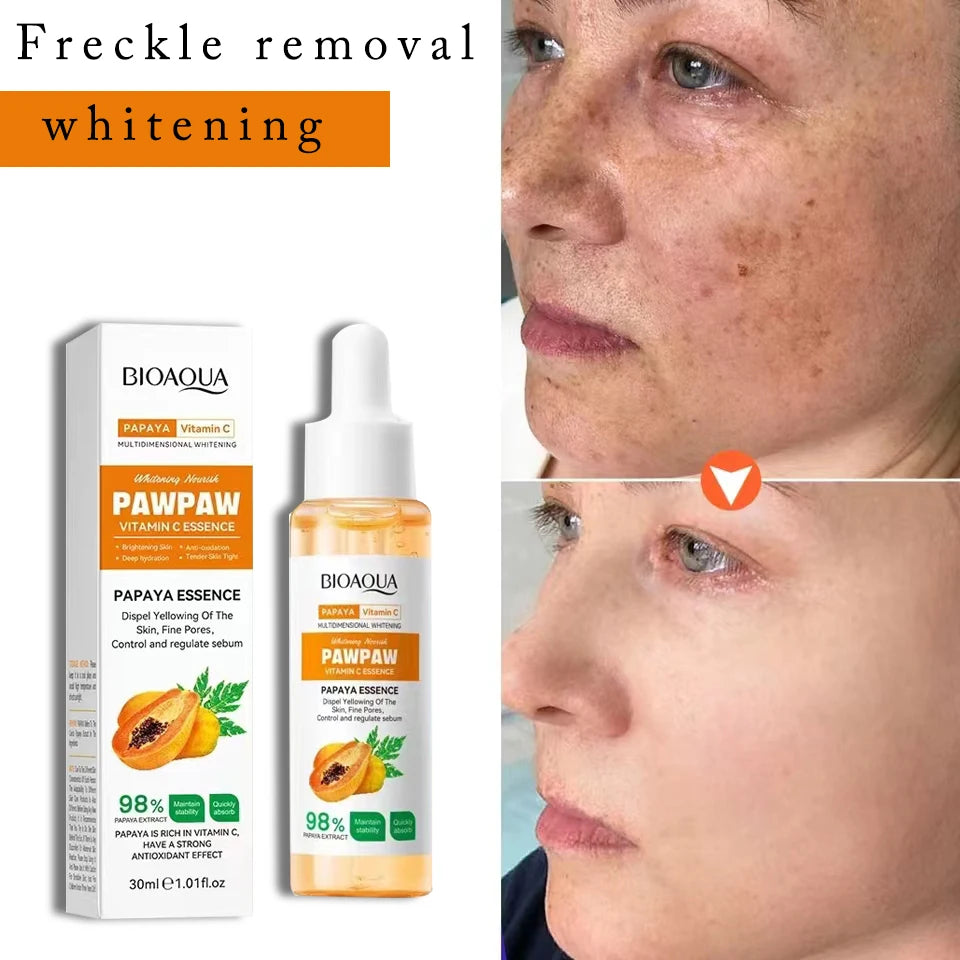 Whitening Serum Effective Remove Freckle Liquid Fade Melanin Fade Dark Spots Melasma Whiten Brighten Skin Care Products