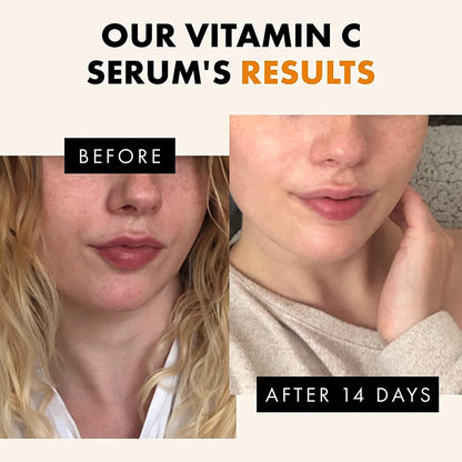 120ml 99% Vitamin C Serum Oil Facial Serum AHA Kojic Acid glutathione Facial skin brightening