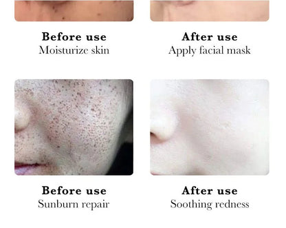 2024 Niacinamide Whitening Freckle Cream Effectively Remove Melasma Cream Lightens Black Spots Acne Marks Brightens Skin Care