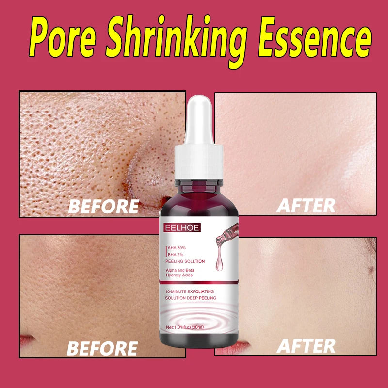 Pore Shrinking Serum Smooth Pores Whitening Moisturizing Anti Aging Brighten Skin Care Product Salicylic Fruit Acid Essence