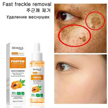 Whitening Serum Effective Remove Freckle Liquid Fade Melanin Fade Dark Spots Melasma Whiten Brighten Skin Care Products