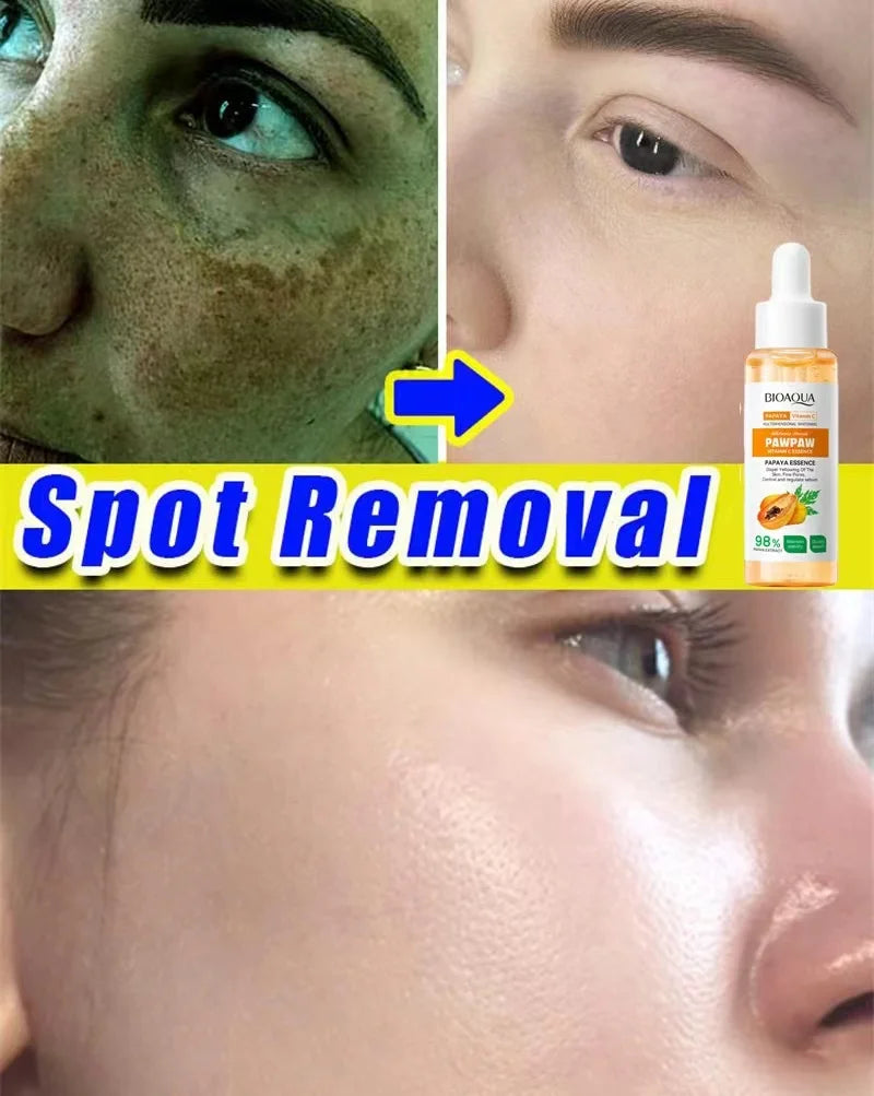 Whitening Serum Effective Remove Freckle Liquid Fade Melanin Fade Dark Spots Melasma Whiten Brighten Skin Care Products