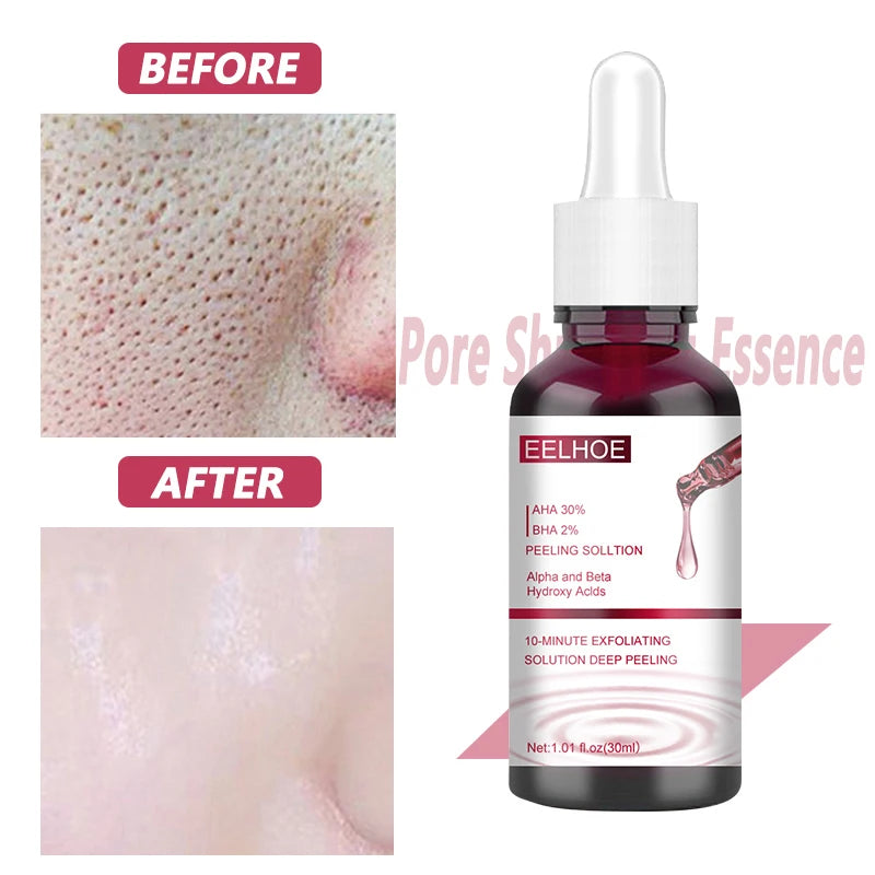 Pore Shrinking Serum Smooth Pores Whitening Moisturizing Anti Aging Brighten Skin Care Product Salicylic Fruit Acid Essence