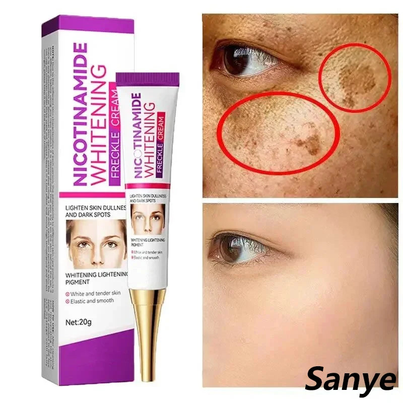 2024 Niacinamide Whitening Freckle Cream Effectively Remove Melasma Cream Lightens Black Spots Acne Marks Brightens Skin Care