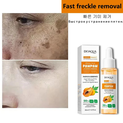 Whitening Serum Effective Remove Freckle Liquid Fade Melanin Fade Dark Spots Melasma Whiten Brighten Skin Care Products