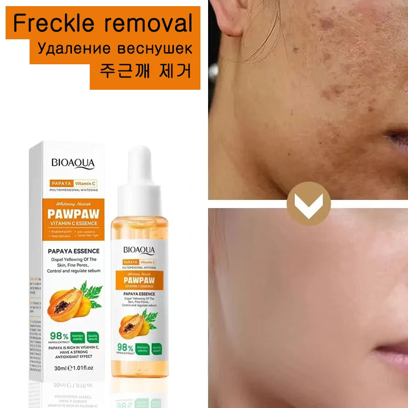 Whitening Serum Effective Remove Freckle Liquid Fade Melanin Fade Dark Spots Melasma Whiten Brighten Skin Care Products