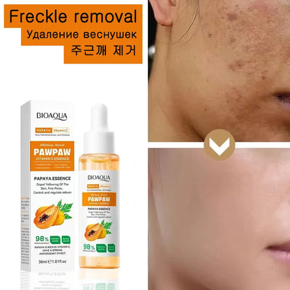 Whitening Serum Effective Remove Freckle Liquid Fade Melanin Fade Dark Spots Melasma Whiten Brighten Skin Care Products